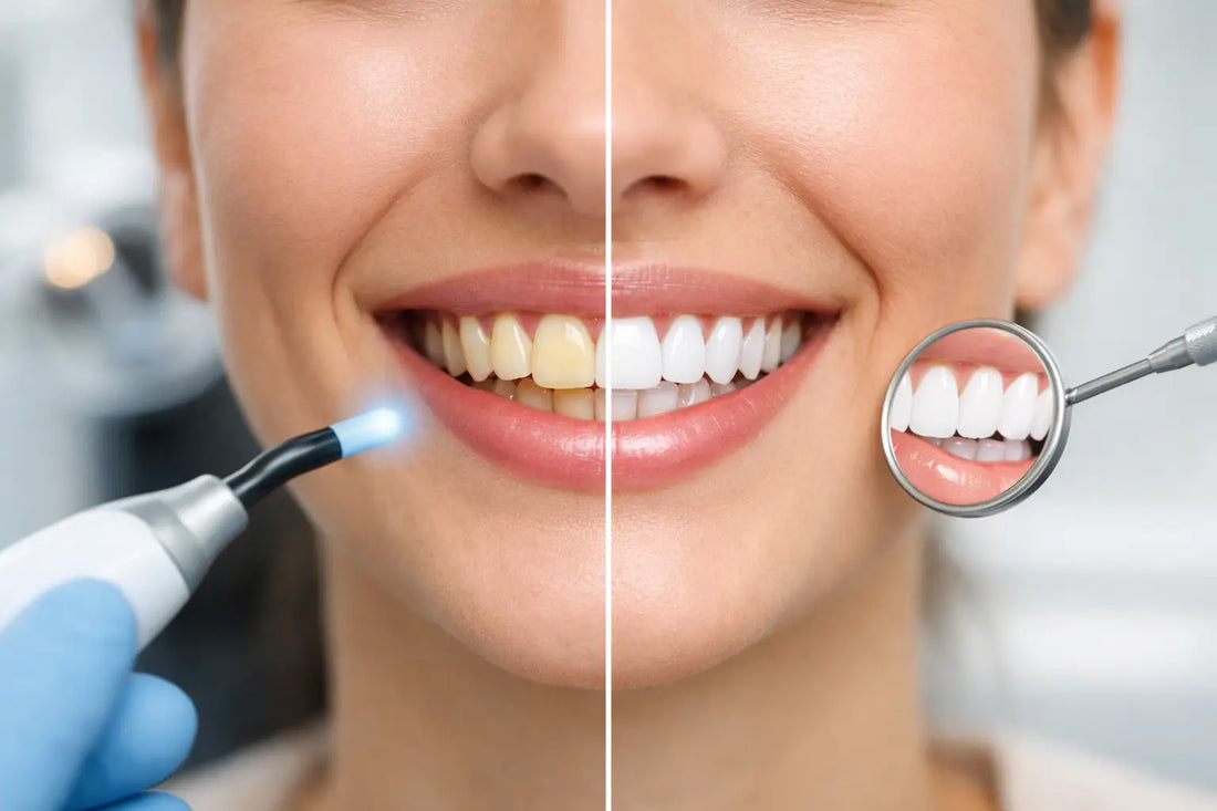 Blanqueamiento dental que sí se nota