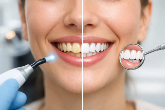 Blanqueamiento dental que sí se nota